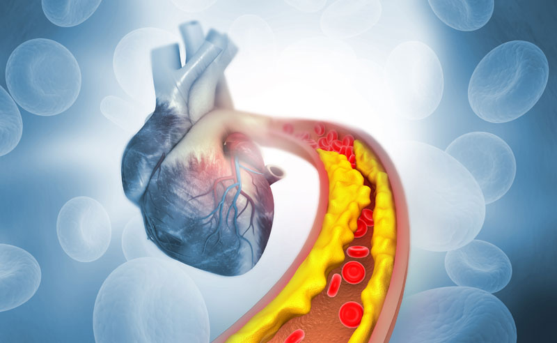 3.2 Reduce cardiovascular risk